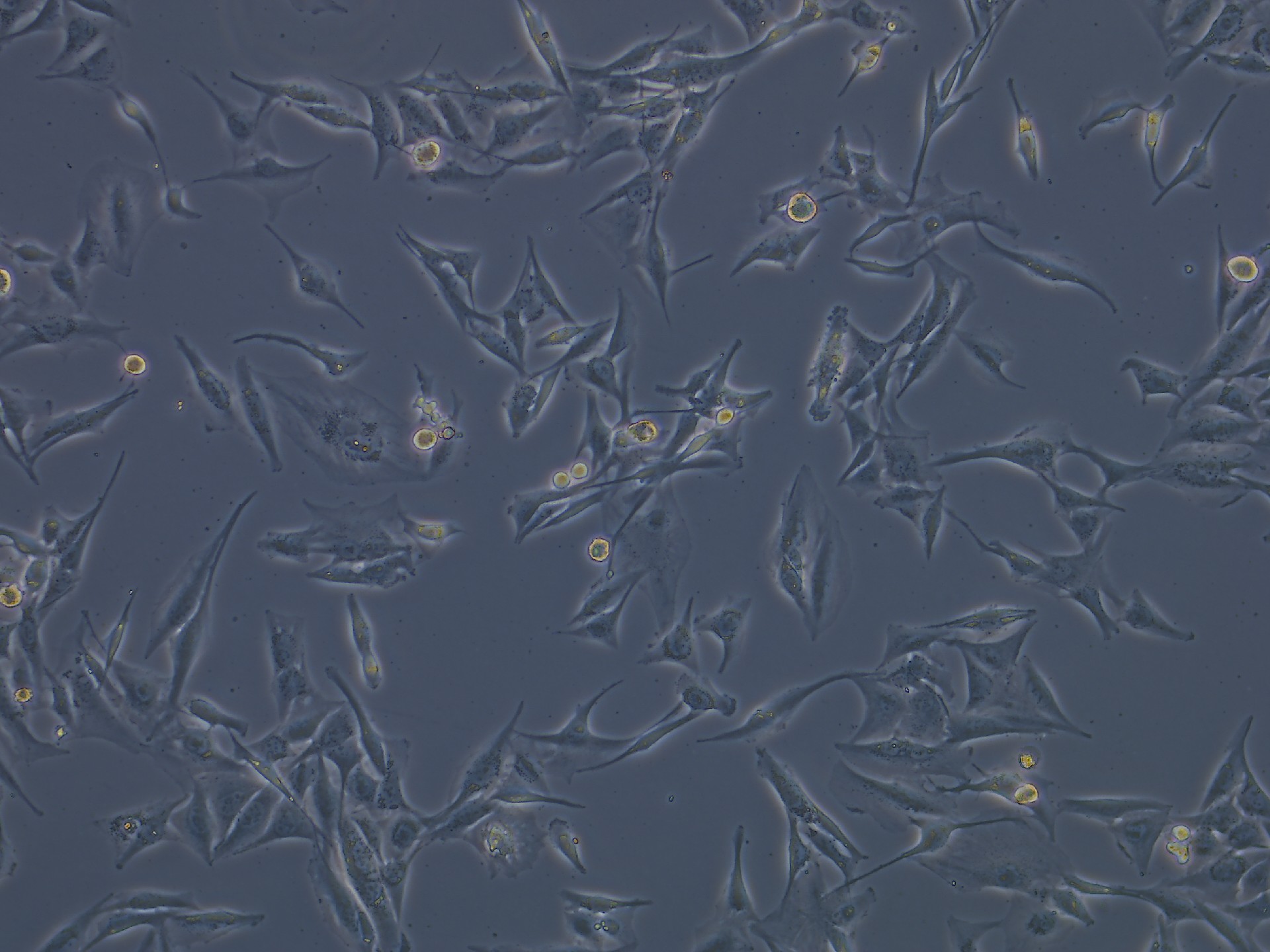 NCl-H1975 Cells(人肺腺癌細胞)